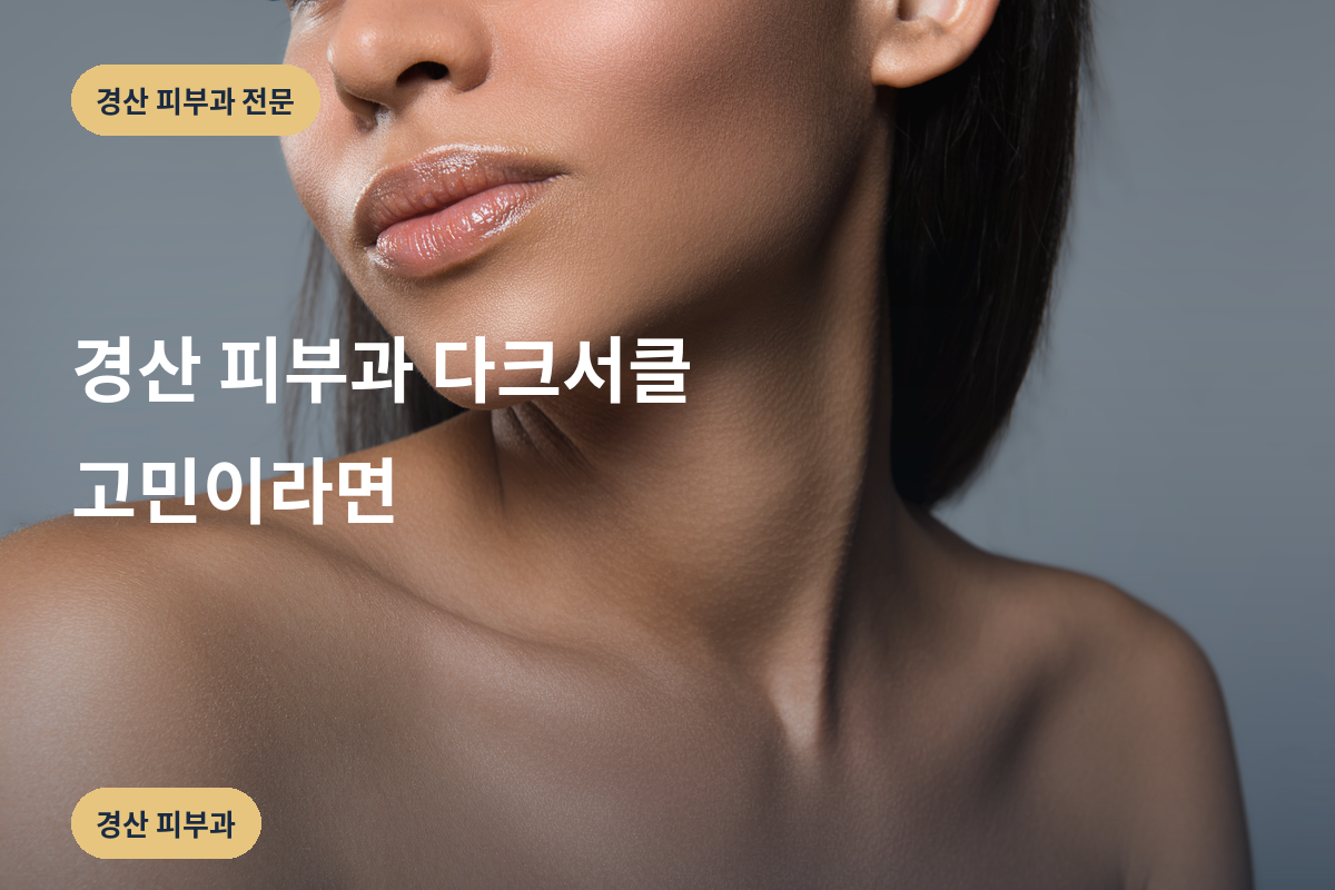 경산 피부과 다크서클 고민이라면