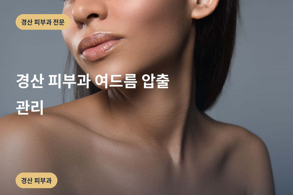 경산 피부과 여드름 압출 관리