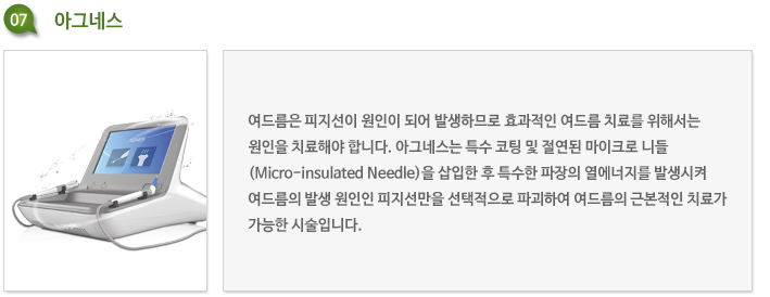 경산 피부과 관자놀이 여드름이 반복되는 자리